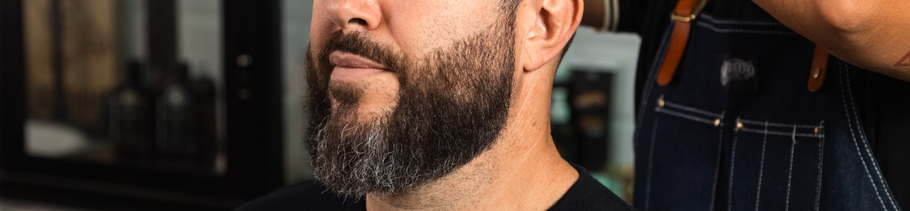 How To Cure Beard Dandruff